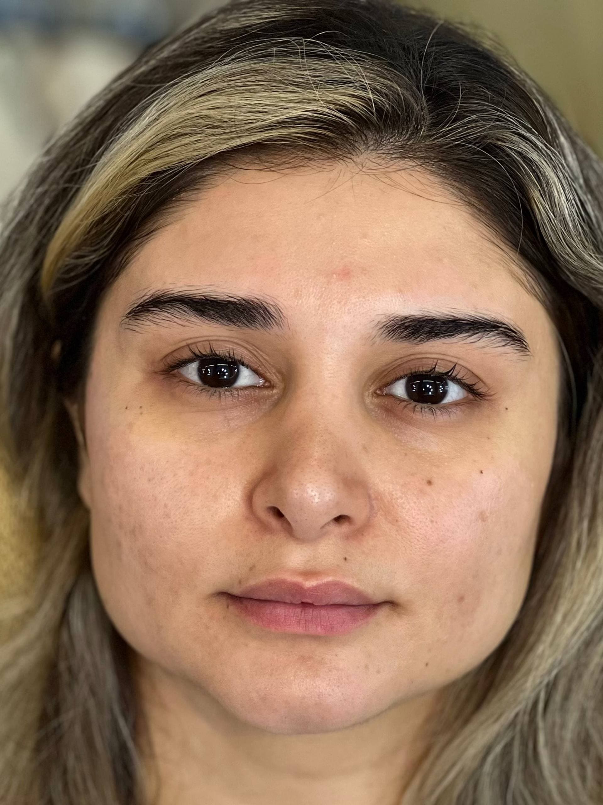 چهره قبل از اجرای میکاپ شاین‌دار در رشت